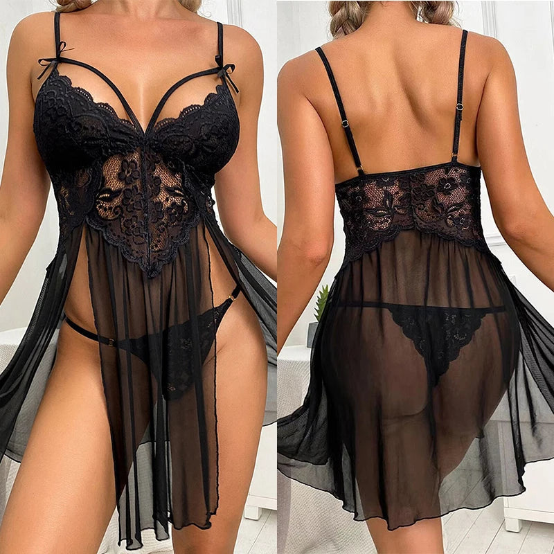 Lace Delight Lingerie Set